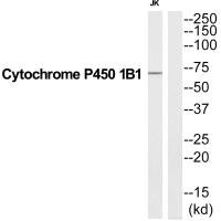 CYP1B1 Antibody