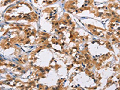 CYP21A2 Antibody