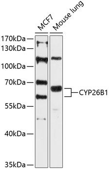 CYP26B1 antibody
