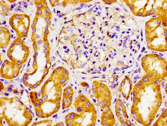 CYP27A1 Antibody