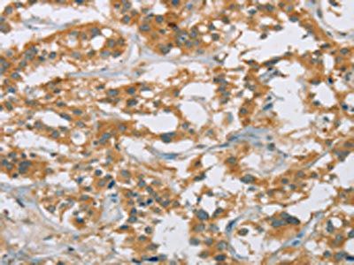 CYP27A1 Antibody