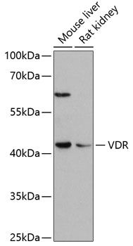 CYP27B1 antibody