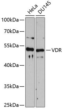 CYP27B1 antibody