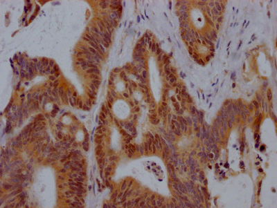 VDR Recombinant Monoclonal Antibody
