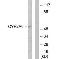 CYP2A6 Antibody