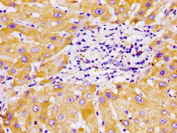CYP2B6 Antibody