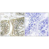 CYP2C8 Antibody