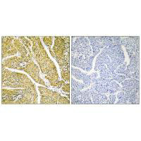 CYP2D6 Antibody