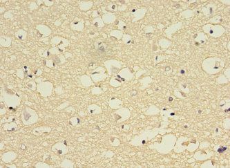 CYP2E1 Antibody