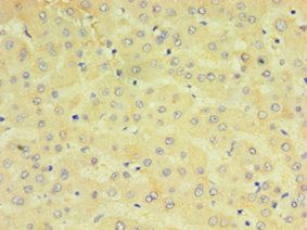CYP2J2 Antibody