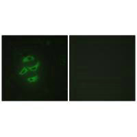 CYP2J2 Antibody