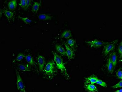 CYP2U1 Antibody