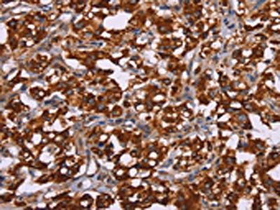 CYP2W1 Antibody