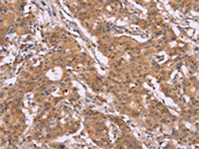 CYP2W1 Antibody
