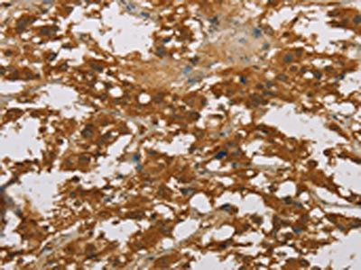 CYP39A1 Antibody