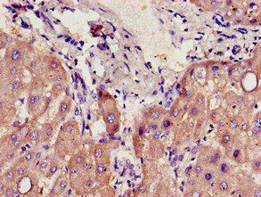 CYP39A1 Antibody