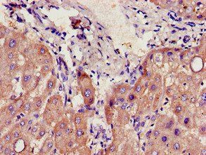 CYP39A1 antibody