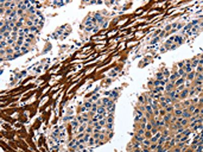 CYP3A4 Antibody