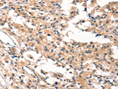 CYP46A1 Antibody