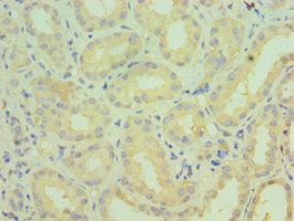 CYP4A11 Antibody