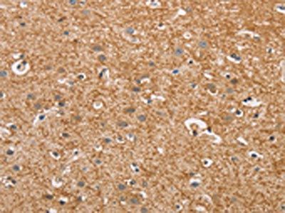 CYP4A11 Antibody