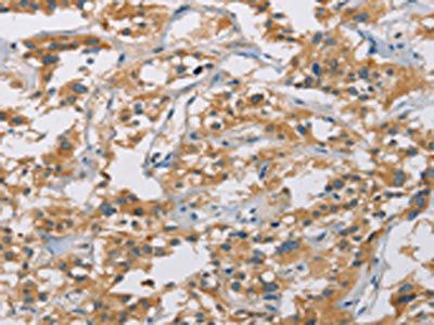 CYP4A11 Antibody