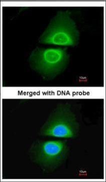 CYP4A11 antibody