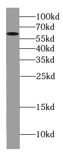 CYP4F11-Specific antibody