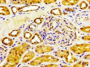 CYP4F2 Antibody