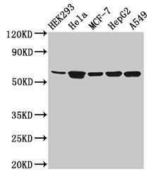 CYP4F22 antibody