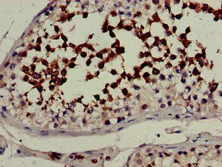 CYP51A1 antibody