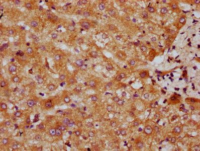 CYP7A1 Antibody