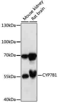 CYP7B1 antibody