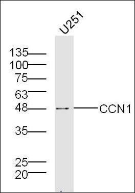 Cyr61 antibody