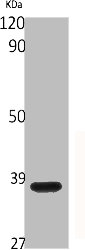 CYSLTR1 antibody