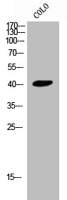 CYSLTR2 antibody