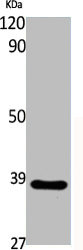 CYSLTR2 antibody