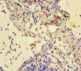CSTB Antibody