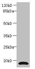 Cystatin C antibody