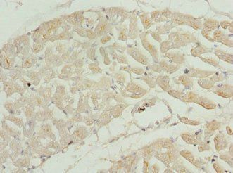 TNNI2 Antibody