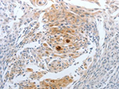 CST3 Antibody