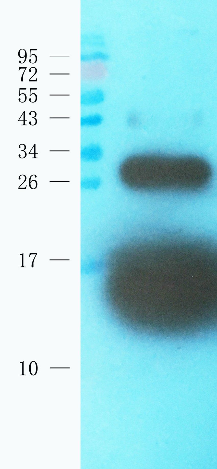 Cystatin C antibody