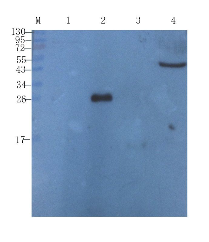 Cystatin C antibody