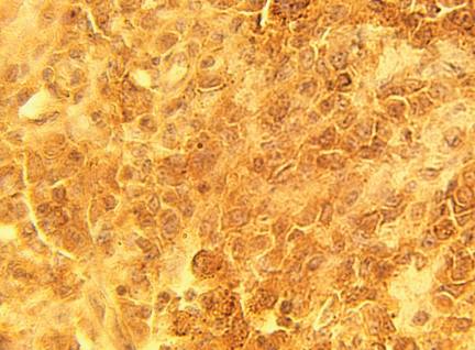 Rabbit anti Human Cysteine string protein (CSP) Alpha, DNAJC5 alpha