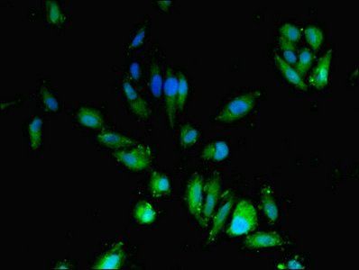 Cytidine deaminase antibody