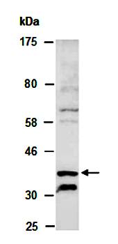 CYTIP (C2) Antibody, Rabbit Polyclonal