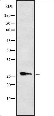 Cytochrome b561 antibody