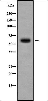 Cytochrome P450 11B2 antibody