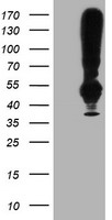Cytochrome P450 17A1 (CYP17A1) antibody