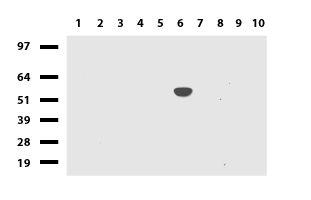 Cytochrome P450 1A2 (CYP1A2) antibody